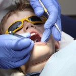dental Veneers is the best restoration option