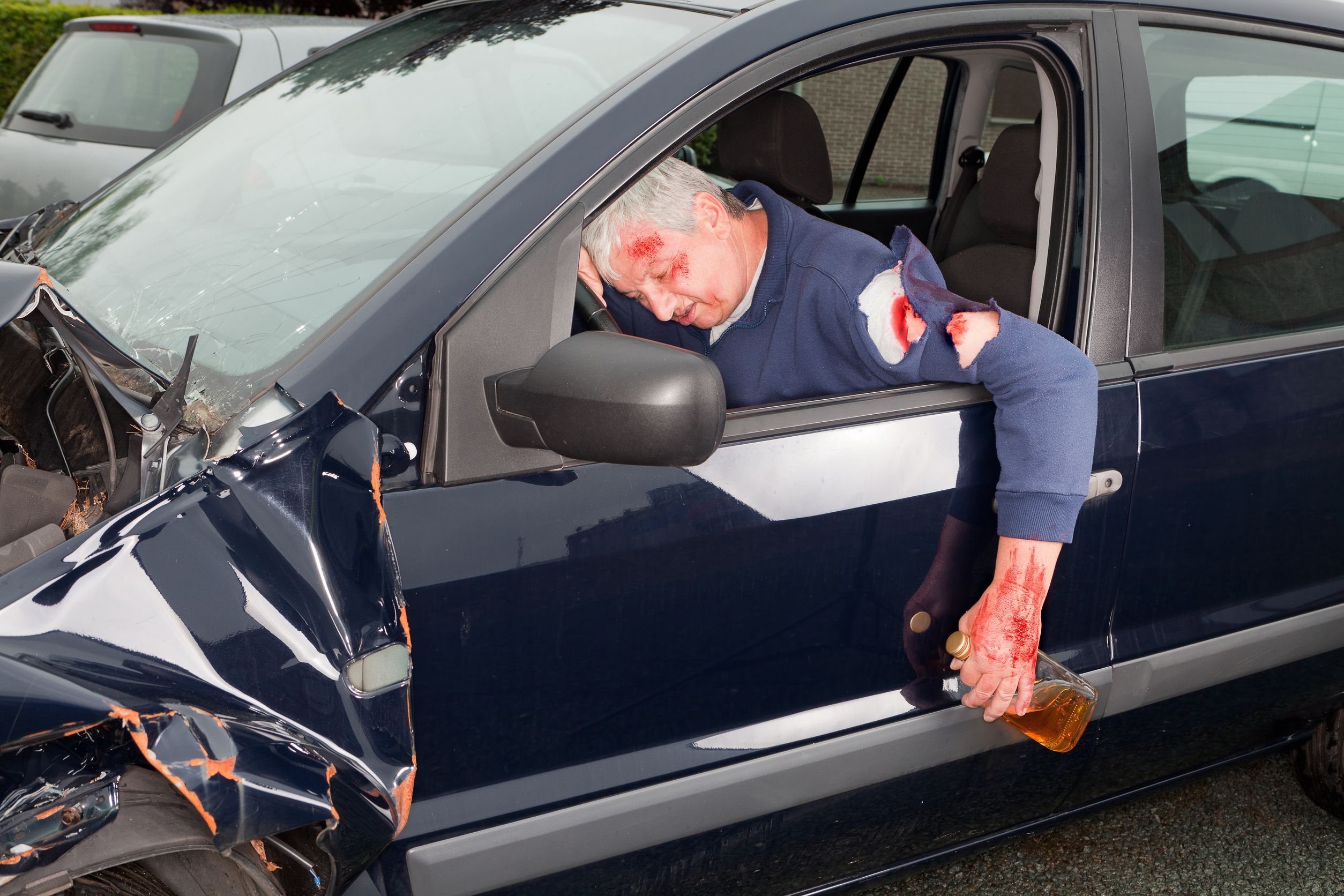 A Car Accident Lawyer Will Benefit Your Case