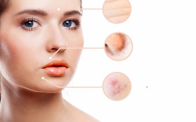 Achieve a Youthful Look with Skin Tightening Treatments at Luxe Beauty & Wellness in Creekside, TX